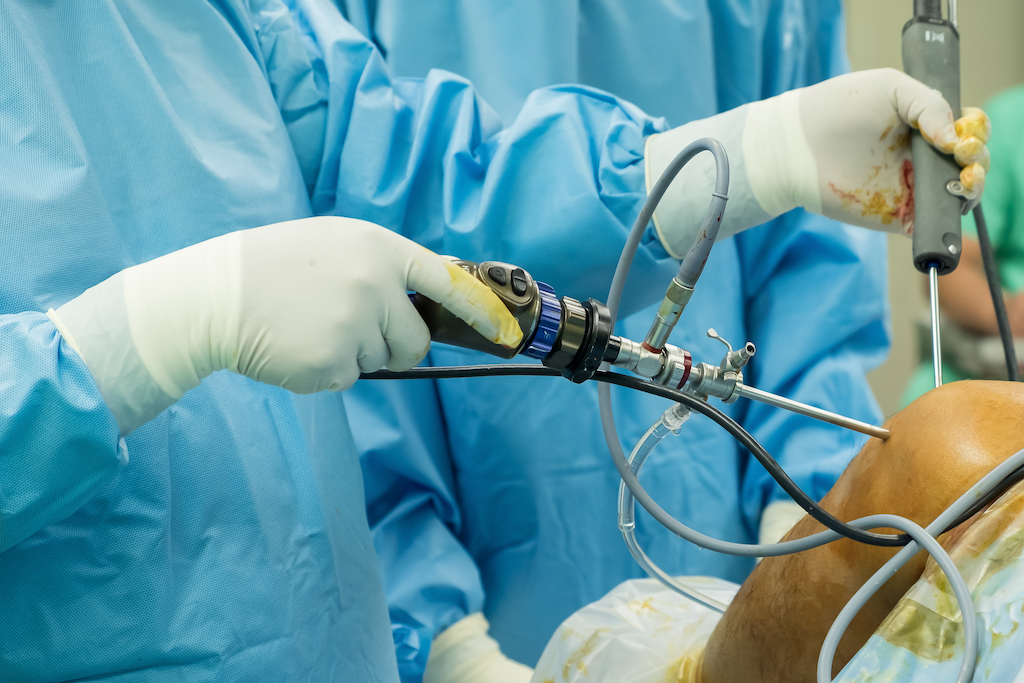 Nee surgery